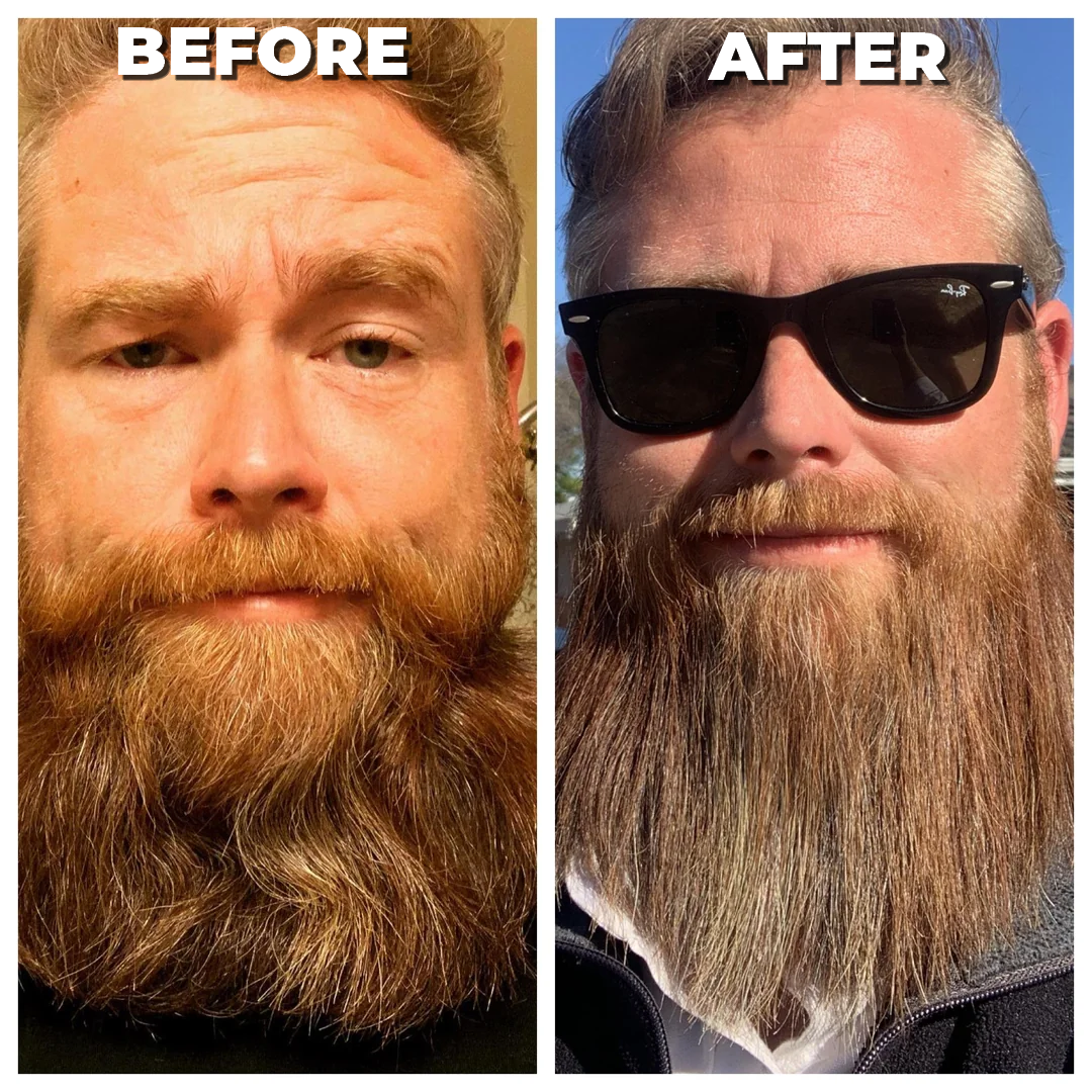 ViceBeard™ Beard Straightener