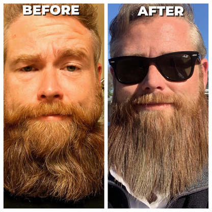 ViceBeard™ Beard Straightener