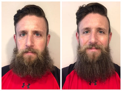 ViceBeard™ Beard Straightener